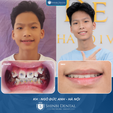 Khách hàng Ngô Đức Anh